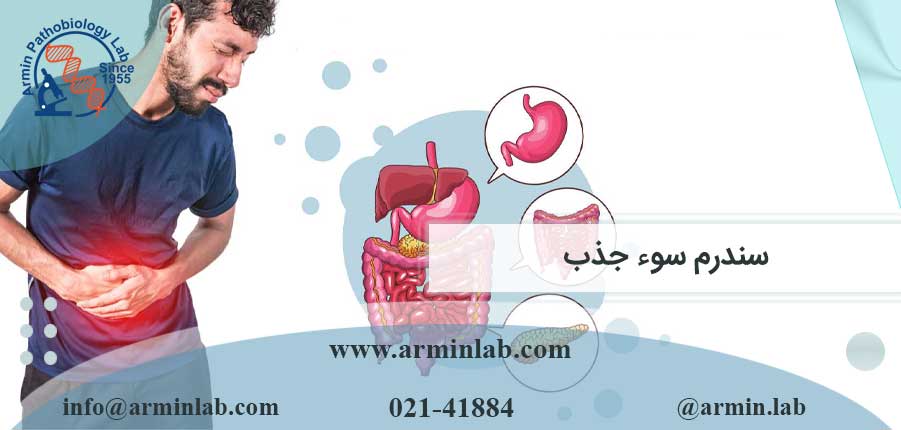 سندرم-سوء-جذب-arminlab سندرم سوء جذب