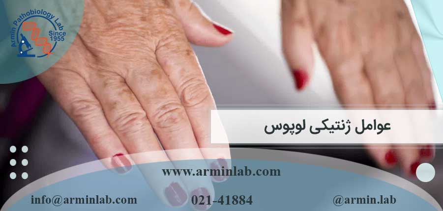 عوامل ژنتیکی لوپوس