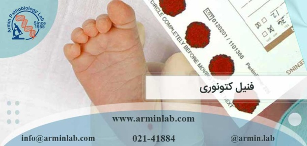 فنیل کتونوری