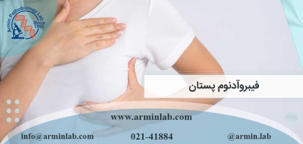 فیبروآدنوم پستان