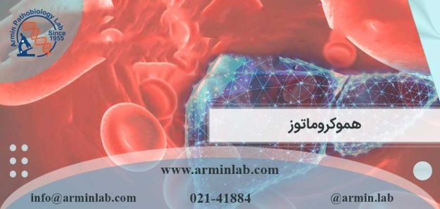 هموکروماتوز