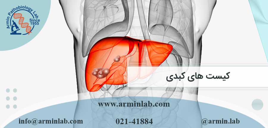 کیست-های-کبدی-arminlab3 کیست های کبدی