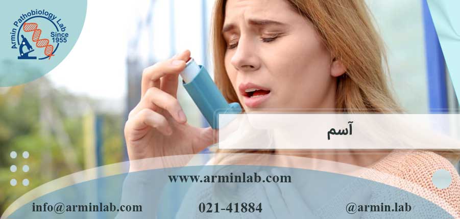 آسم چیست؟