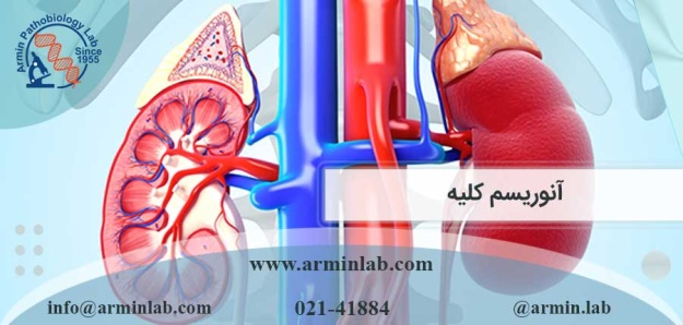 آنوریسم کلیه