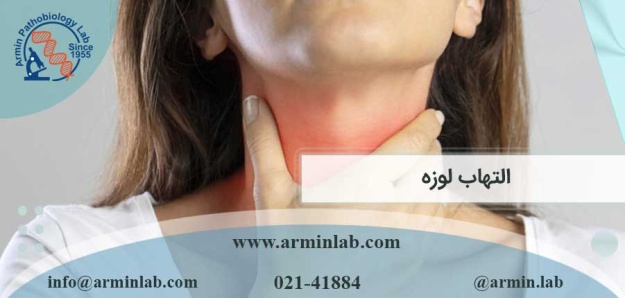 علل شایع التهاب لوزه چیست؟