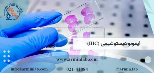 ایمونوهیستوشیمی (IHC)
