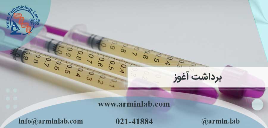 برداشت آغوز