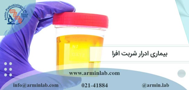 بیماری ادرار شربت افرا