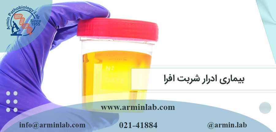بیماری ادرار شربت افرا