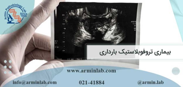 بیماری تروفوبلاستیک بارداری