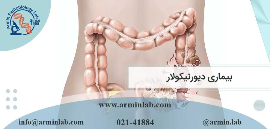 بیماری-دیورتیکولار-arminlab بیماری دیورتیکولار