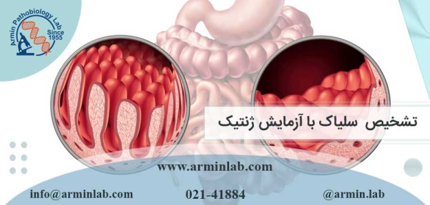 تشخیص سلیاک با آزمایش ژنتیک