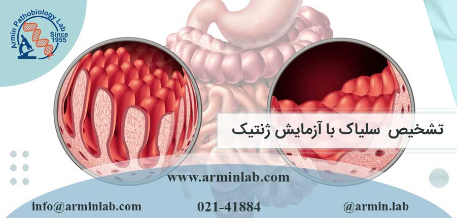 تشخیص سلیاک با آزمایش ژنتیک