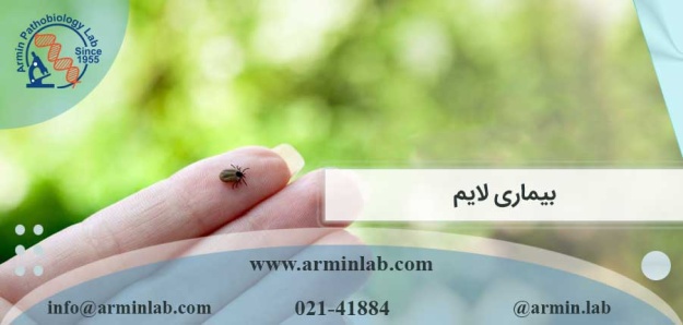 بیماری لایم