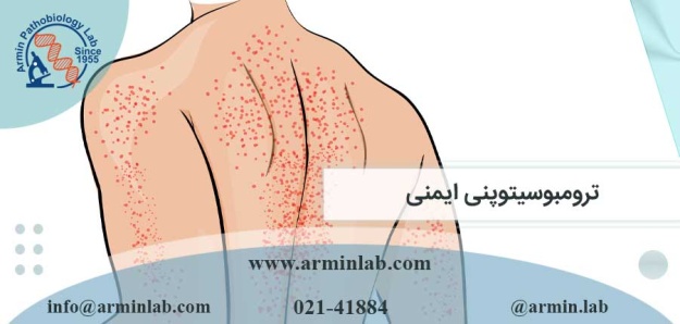 ترومبوسیتوپنی ایمنی