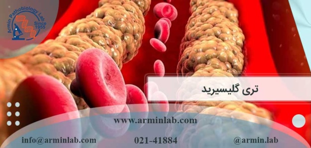 تری گلیسیرید