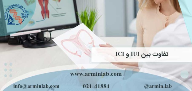 تفاوت بین IUI و ICI