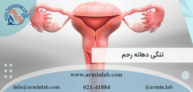 تنگی دهانه رحم