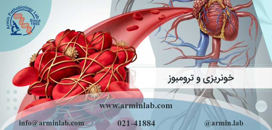 خونریزی و ترومبوز