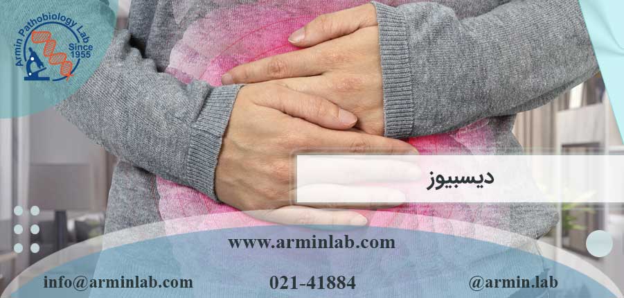 دیسبیوز چیست؟