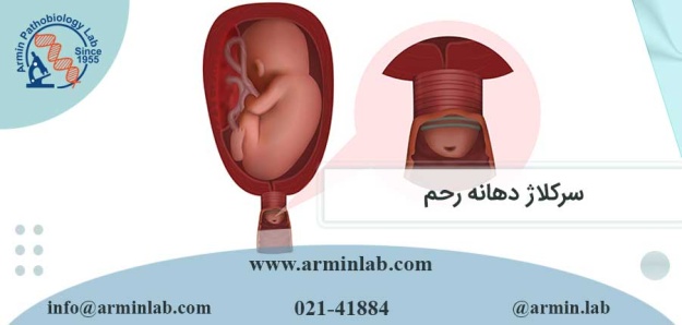 سرکلاژ دهانه رحم