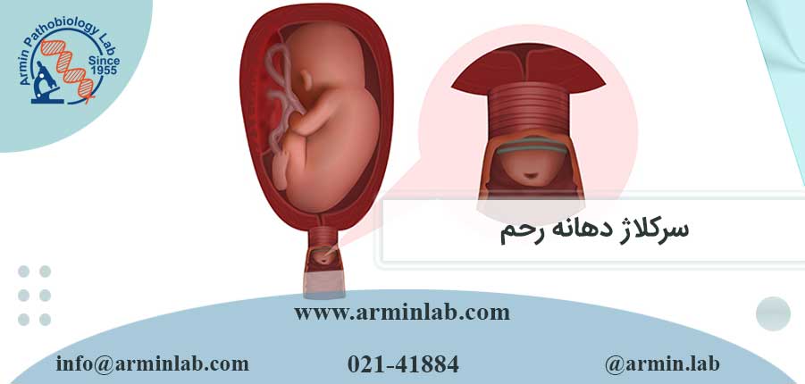 سرکلاژ دهانه رحم
