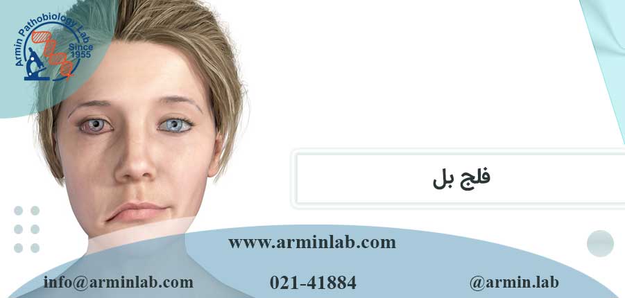 فلج بل چیست؟