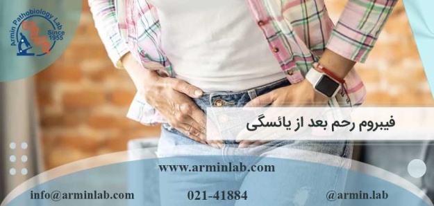 فیبروم رحم بعد از یائسگی