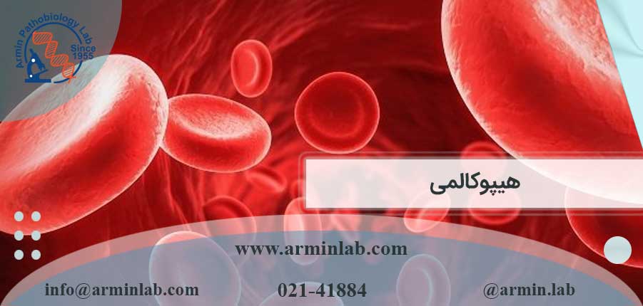 هیپوکالمی-arminlab هیپوکالمی