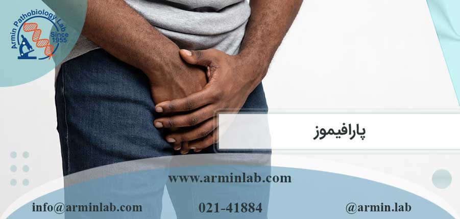 پارافیموز-arminlab پارافیموز