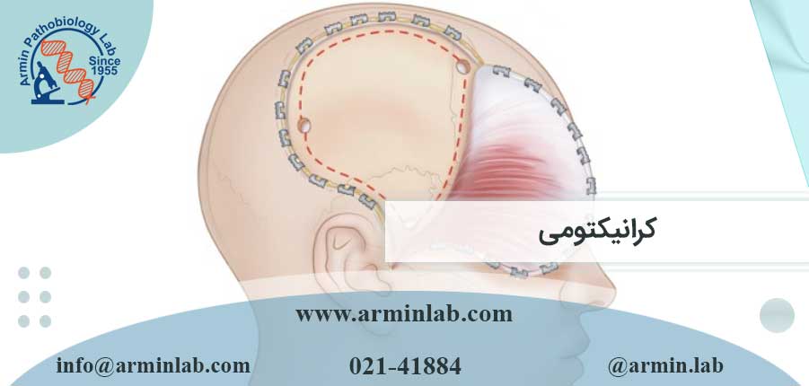 کرانیکتومی