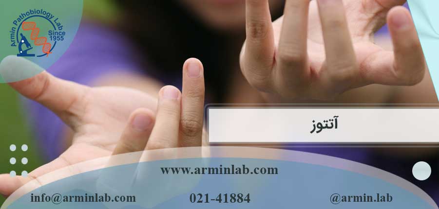 آتتوز-arminlab آتتوز