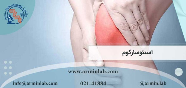 استئوسارکوم