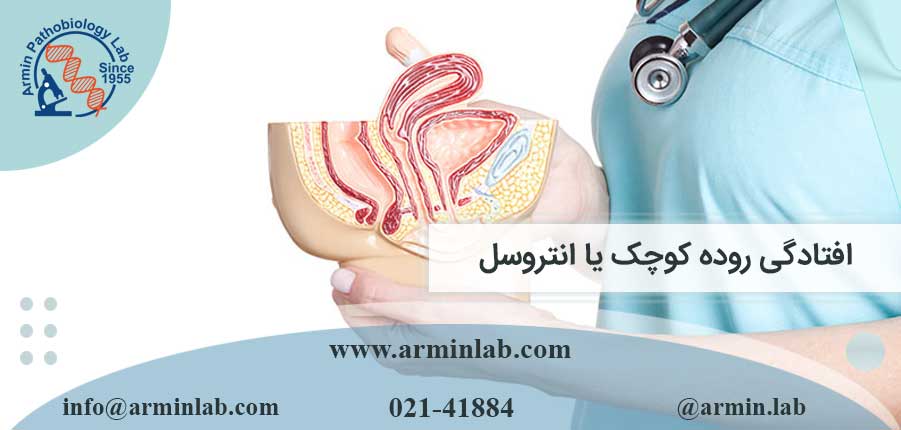 افتادگی-روده-کوچک-یا-انتروسل-arminlab افتادگی روده کوچک یا انتروسل