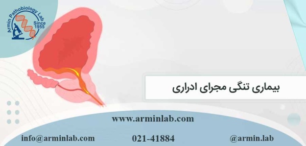 بیماری تنگی مجرای ادراری