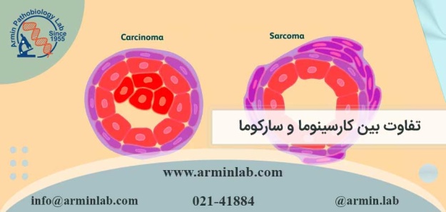 تفاوت بین کارسینوما و سارکوما