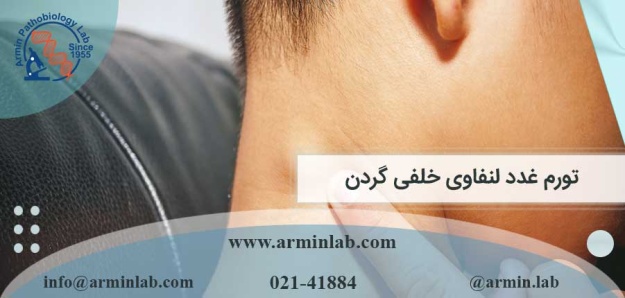 تورم غدد لنفاوی خلفی گردن