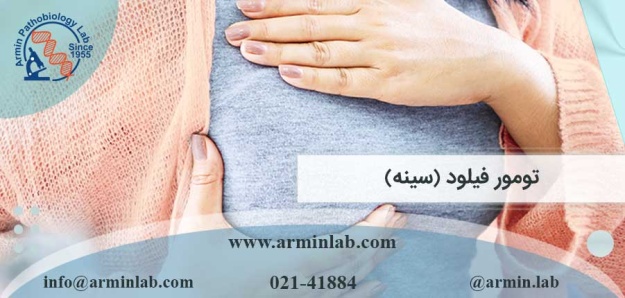 تومور فیلود (سینه)