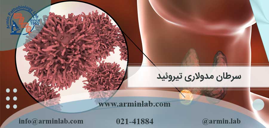 سرطان مدولاری تیروئید چیست؟