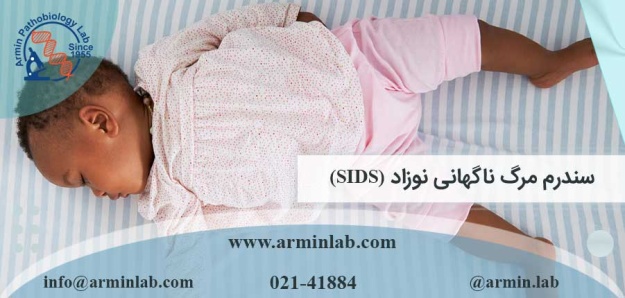 سندرم مرگ ناگهانی نوزاد (SIDS)