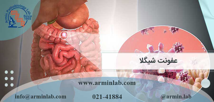 عفونت شیگلا