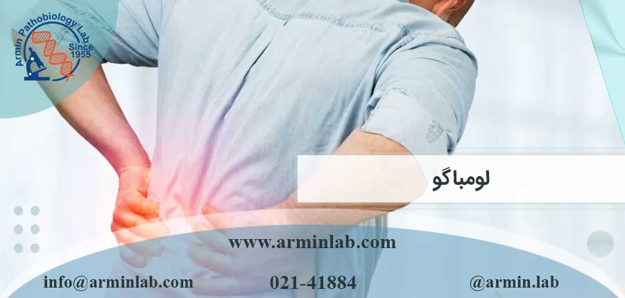 لومباگو-arminlab لومباگو