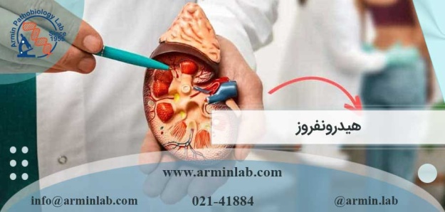 هیدرونفروز