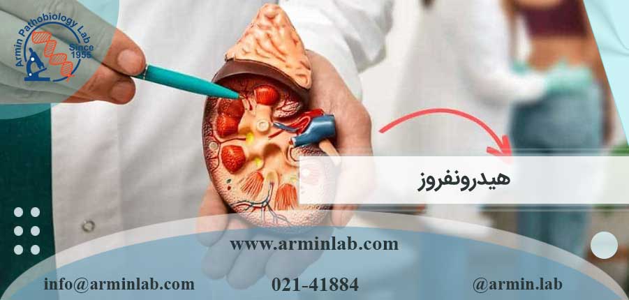 هیدرونفروز