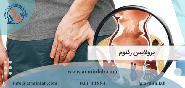 پرولاپس رکتوم