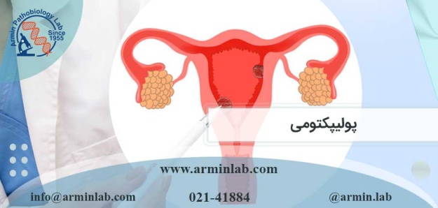 پولیپکتومی