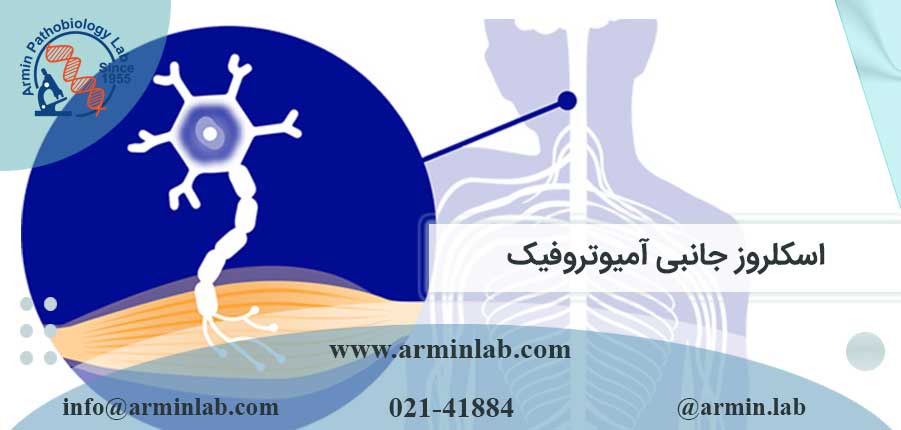 اسکلروز-جانبی-آمیوتروفیک-arminlab اسکلروز جانبی آمیوتروفیک