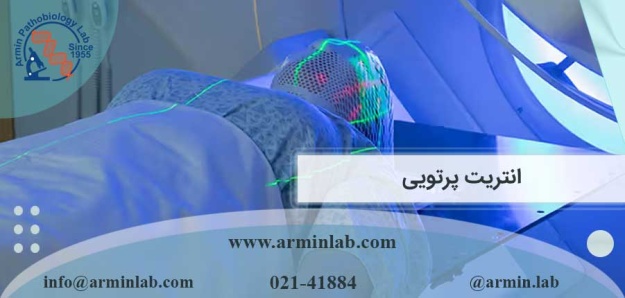 انتریت پرتویی