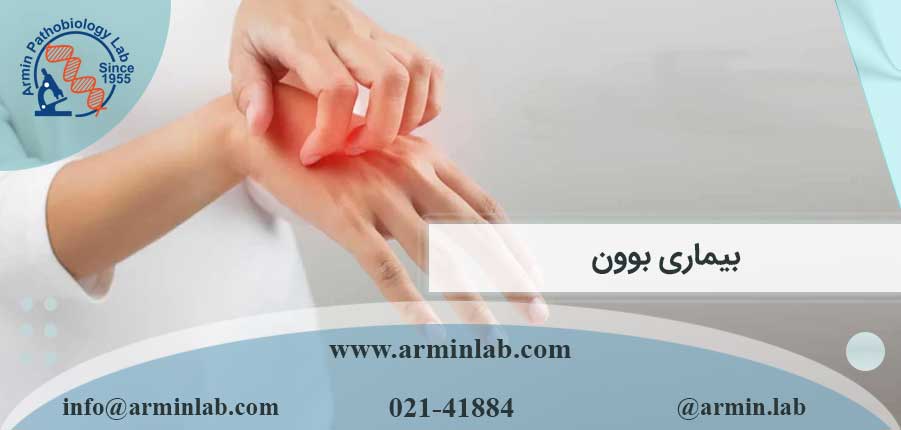 بیماری بوون