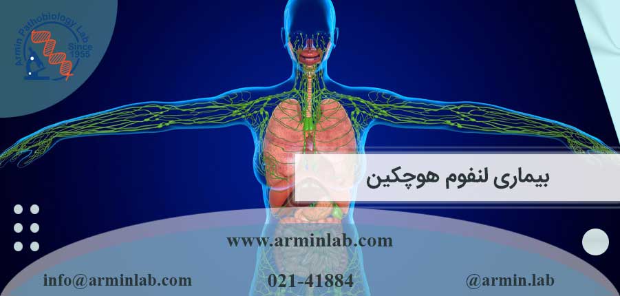 بیماری لنفوم هوچکین